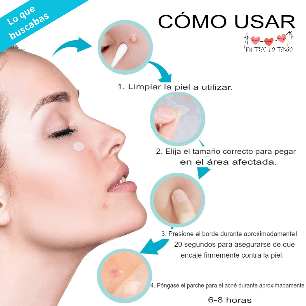 Parches para acné